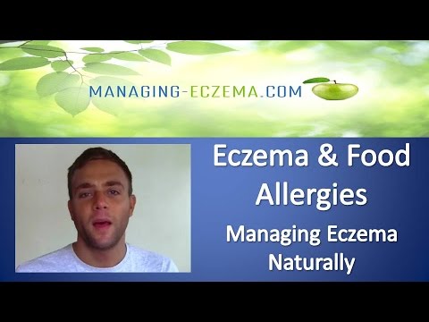 eczema-and-food-allergies