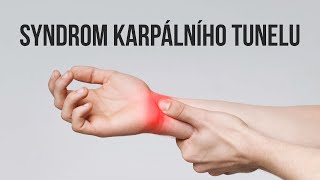 "KARPÁL" - Syndrom karpálního tunelu