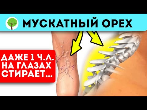 Зачем есть мускатный орех? Лечебный свойства ореха впечатляют