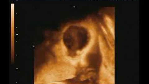 sarah tangen week 33 ultrasound