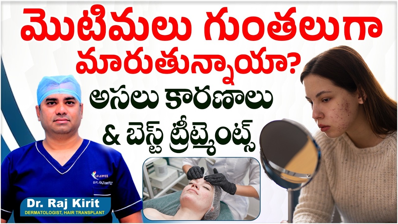 Pits Must Rid How to Get Rid of Pimples, Marks & Pits | Causes, Types, Diet ...