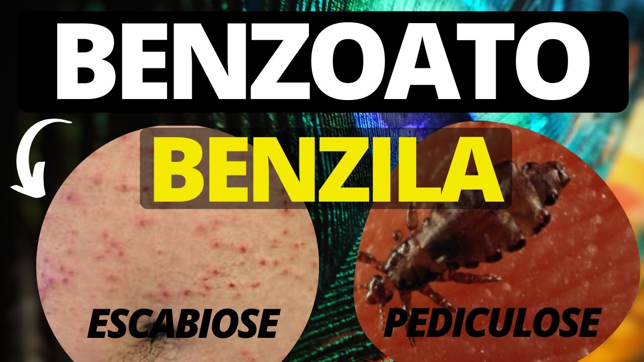 Quanto Tempo Deixar O Benzoato De Benzila No Corpo?