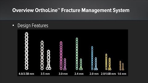 OrthoLine™ Fracture Management System: Design Features