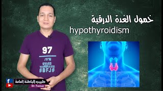 خمول الغدة الدرقية / hypothyroidism