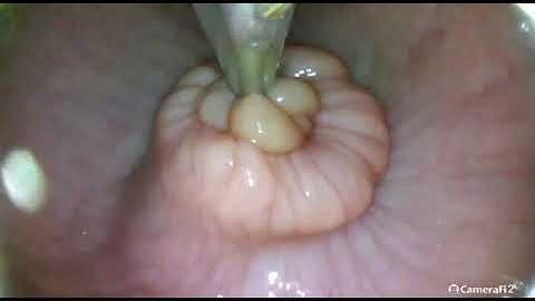 Digital AI GUN for Artificial Insemination in Bovine