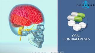 Migraine mechanism of disease (MoD) - 3D medical animation