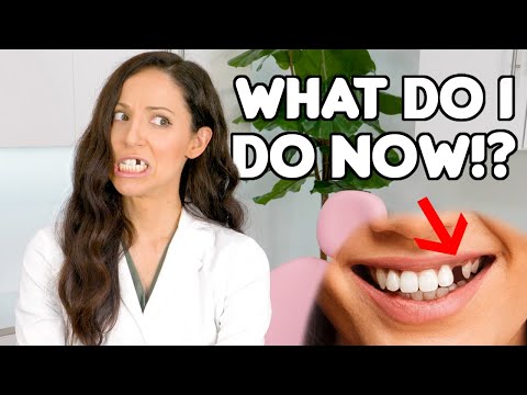 How To REPLACE A Missing Tooth (Best Tooth Replacement Options)