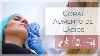 Labios Juicy Lips, Naturales Y Sensuales Coral Clínicas Leclinics
