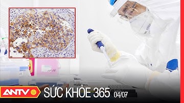 Phương Pháp Xét Nghiệm Hóa Mô Miễn Dịch Có Gì Đáng Lưu Ý? | Sức khỏe 365 | ANTV
