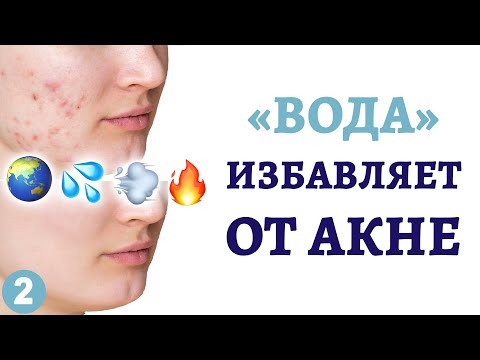 Средства от акне прыщей на уровне «Вода»