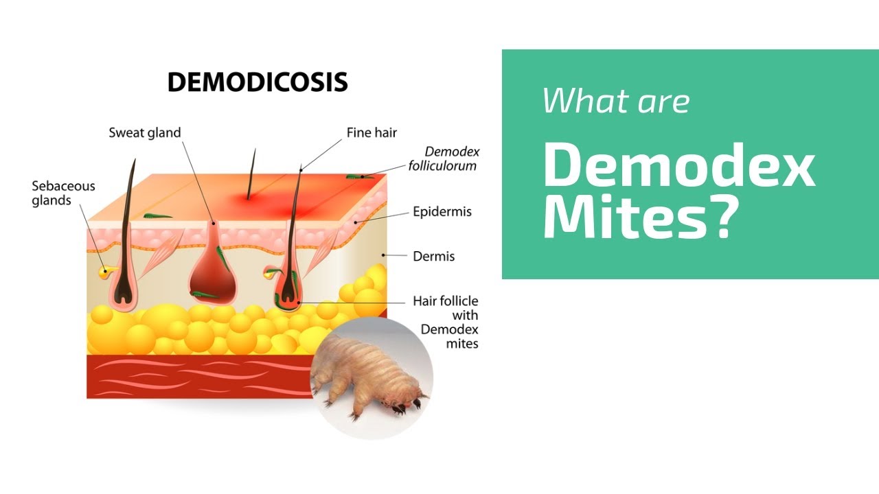 What Are Demodex Mites? Face Mite, Hair Mite | UNGEX - YouTube