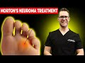 Morton's Neuroma Home Treatment 2020! [NO Surgery For Foot Neuromas!]