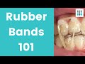 RUBBER BANDS FOR INVISALIGN CLEAR ALIGNERS & BRACES l Dr. Melissa Bailey Orthodontist