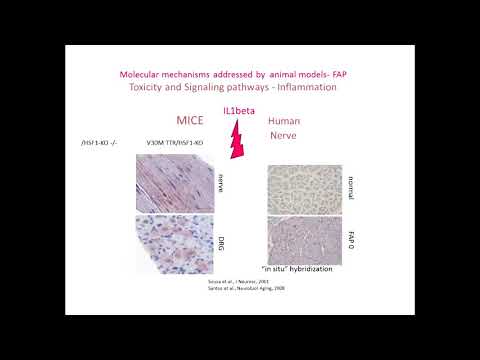 Video: Autosomal-dominerende Transthyretin (TTR) -relateret Amyloidose Er Ikke En Hyppig CMT2-neuropati “i Forklædning”