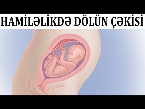 Dölün çəkisi nədən asılıdır? - BUNLARA diqqət edin