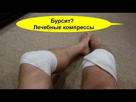 Видео: Ненормално оцветена урина: видове, причини и лечение