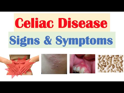 Celiac Disease Signs & Symptoms | Nutrient Deficiencies & Why Symptoms Happen