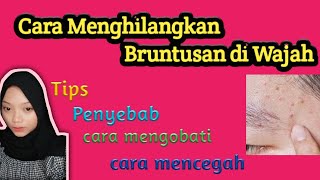 Cara Menghilangkan Bruntusan di Wajah