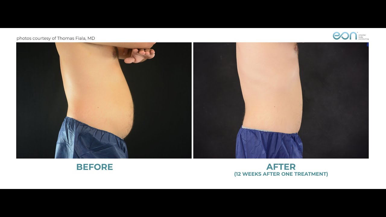 North Texas Plastic Surgery Dallas, Texas YouTube