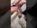 MICRONEEDLING Salmon Dna #letyourskinspeakarmoraa