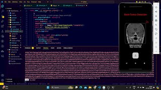 BrainTumor Detection App