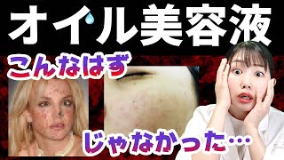 【オイル美容液】使い方を間違えると『ニキビが増えて老け顔になる』理由