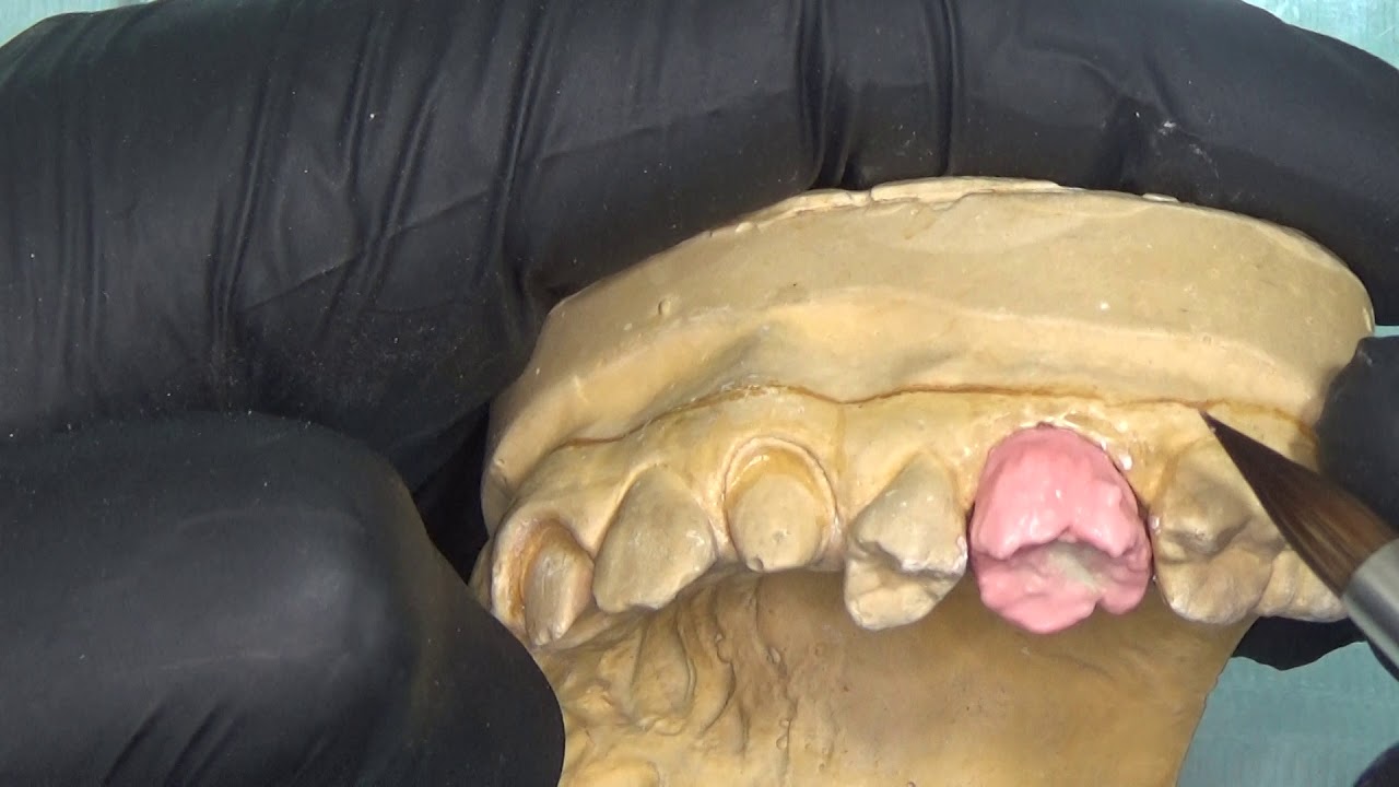 build up  simple first upper molar dentine + enamel بناء سيراميك مبسط لرحى العلوية part 1