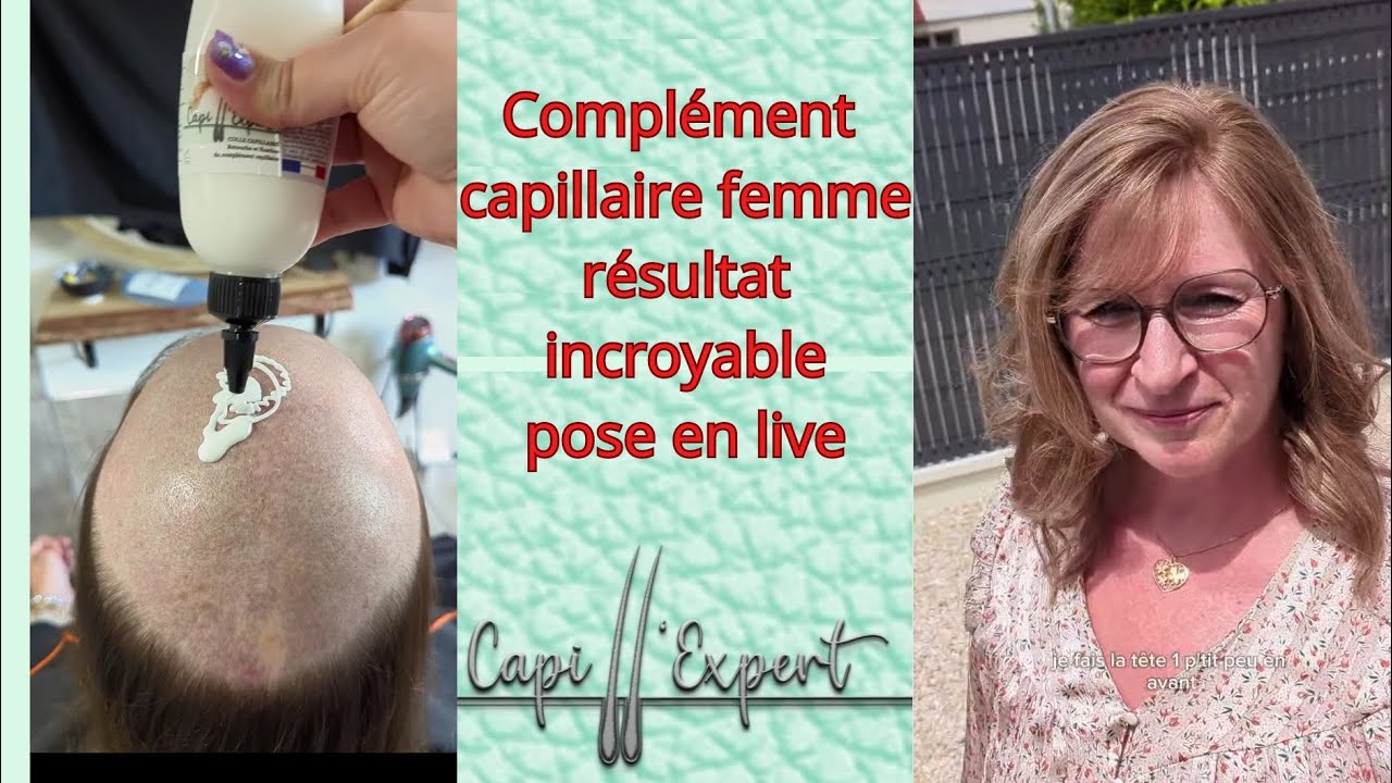 Complement Capillaire A Vie