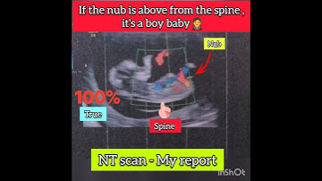 Ultrasound scan report baby boy or girl? Gender reveal #shorts #genderreveal #ultrasound #boyorgirl