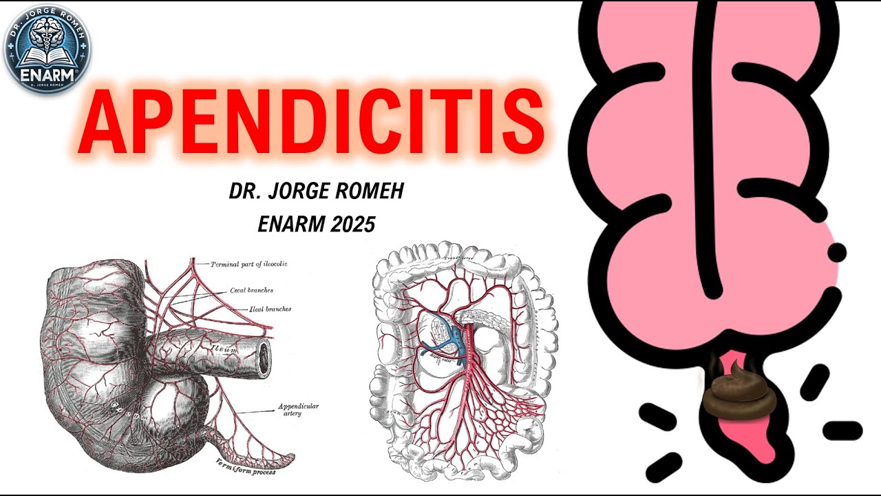 APENDICITIS - ENARM 2025 - TODO LO QUE NECESITAS SABER