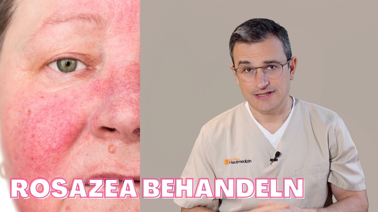 Rosacea 3: Pflege