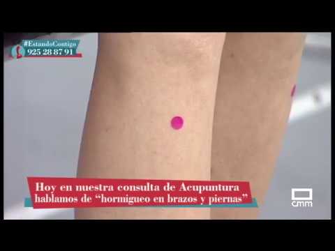 Acabamos con el hormigueo en brazos y piernas