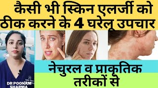 स्किन एलर्जी को ठीक करने के 4 घरेलू इलाज | 4 Effective Home Remedies For Skin Allergy  #skinallergy