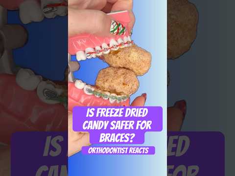 IS FREEZE DRIED CANDY SAFER FOR BRACES Orthodontist Reacts braces candy crunchy