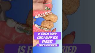 Is Freeze Dried Candy Safer For Braces? Orthodontist Reacts