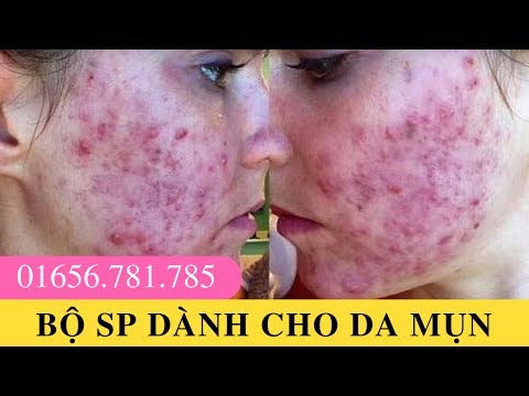 Bộ sản phẩm dành cho da mụn, da tổn thương, da nhiễm corticoid