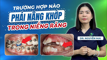 Tất cả những trường hợp NIỀNG RĂNG cần "NÂNG KHỚP" sẽ có trong video này!