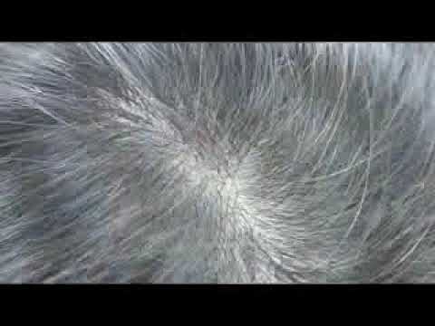 増毛例1 ボリュームエクステ実例800本 Youtube 増毛例1 ボリュームエクステ実例800本 Youtube