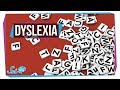 Understanding Dyslexia and Related Research
