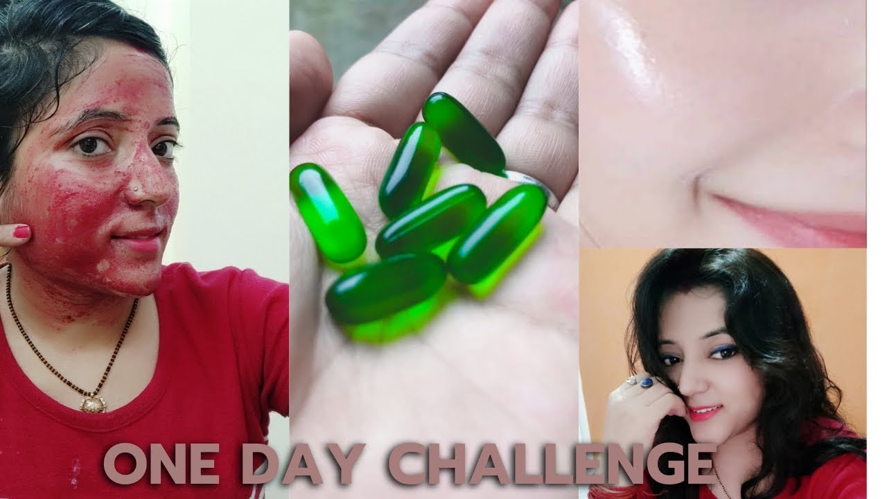 How To Use Vitamin E Capsules For Facial Vitamin E Capsule Facial