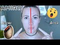 AMIRO S1 Facial RF Skin Tightening Device Review AMIRO Dedicated Facial Mask Preparation Gel 