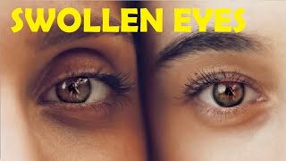 how to get rid of swollen eyes in the morning from allergies