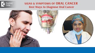 Spotting MOUTH CANCER Signs and symptoms early | Oral Cancer - Dr.Nishath Sabreen | Doctors' Circle