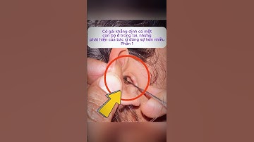 [P.1] Cô gái khẳng định có một con bọ ở trong tai #shorts