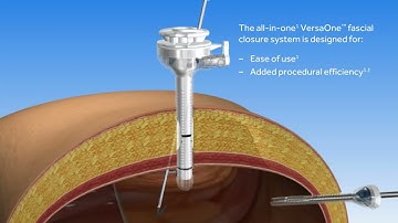 VersaOne™ Fascial Closure System Animation Video