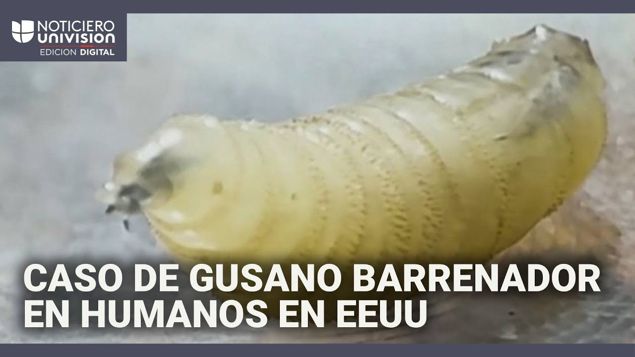 Primer caso de infección por gusano barrenador relacionado con viajes en EE.UU.