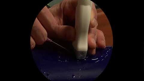 POCUS Guided Vascular Access Fundamentals: Out-of-Plane, Short Axis