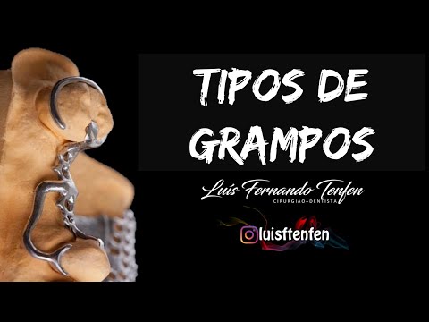 Vídeo: Grampo Grampo: tipos e suas características