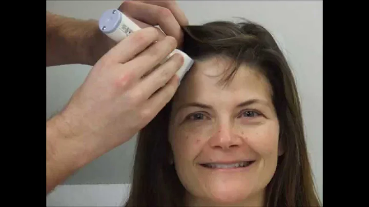 Lori Conti ~ CRANIOTOMY for my BRAIN TUMOR