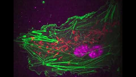 RCM / Timelapse imaging of HUVECs stained for Actin Mitochondria and Nucleus